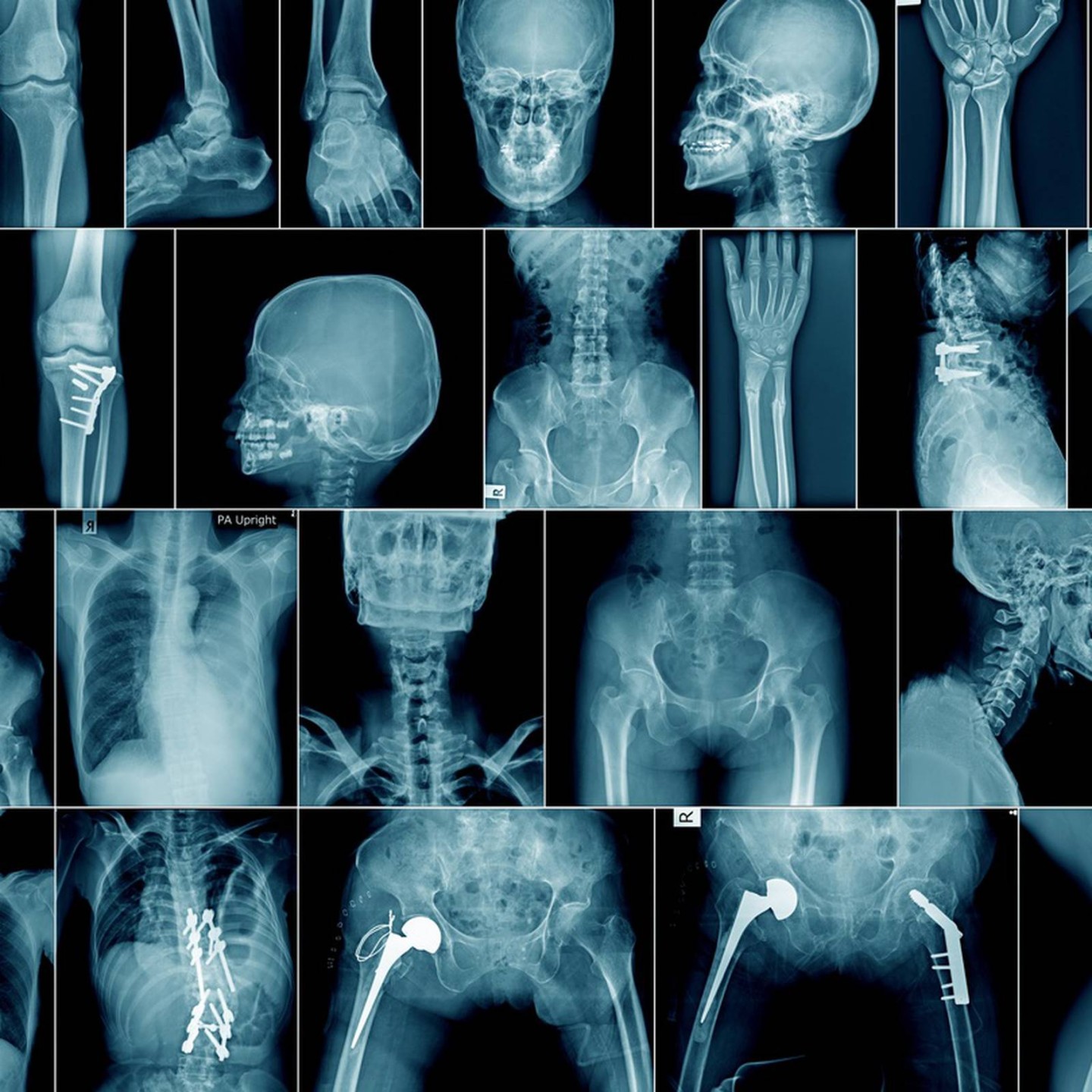 Perbedaan X Ray, Ct Scan, dan MRI Berdasarkan Fungsi dan Cara Kerja!