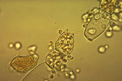 ciri spora yg dihasilkan & bentuk tubuh buah yg terbentuk pada fase reproduktif Chytridiomycota: Pengertian, Ciri, Struktur Tubuh, Contoh & Peranannya