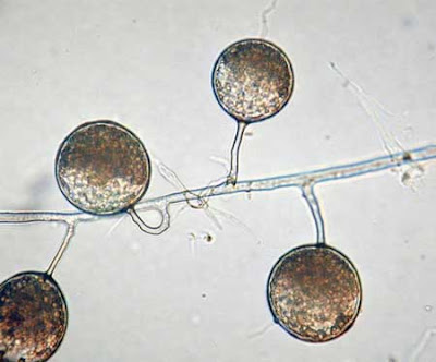 ciri spora yg dihasilkan & bentuk tubuh buah yg terbentuk pada fase reproduktif Glomeromycota: Pengertian, Ciri, Struktur, Reproduksi, Contoh & Manfaat