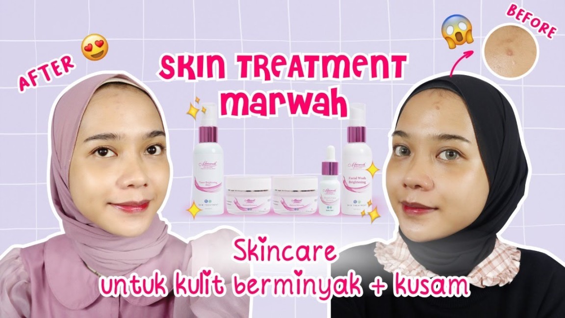 Review Skincare Marwah Untuk Kulit Berminyak